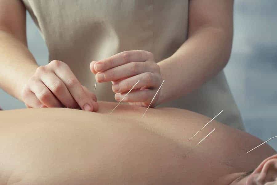 Acupuncture and Chinese Medicine – NEW