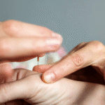 Acupuncture LR4 hand needling